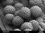 Ambrosie Pollen © Agroscope ACW Ambrosie Pollen © Agroscope ACW
